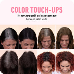 Boldify before and after hairline showing fuller-looking edges and natural blend