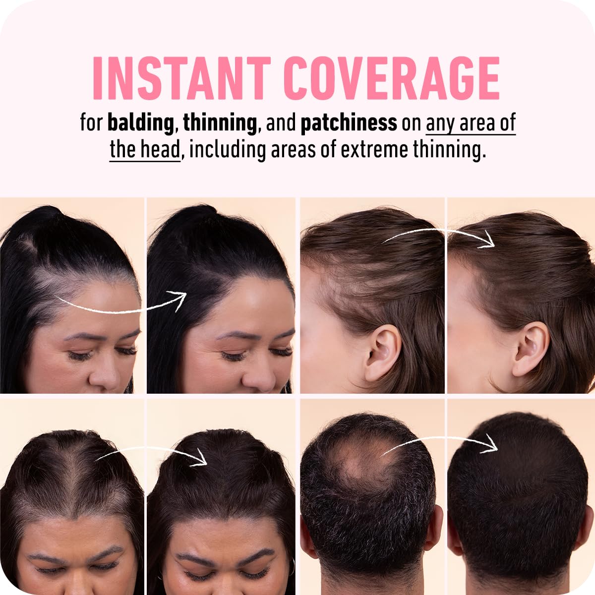 Boldify applied at temple illustrating targeted gray root concealment