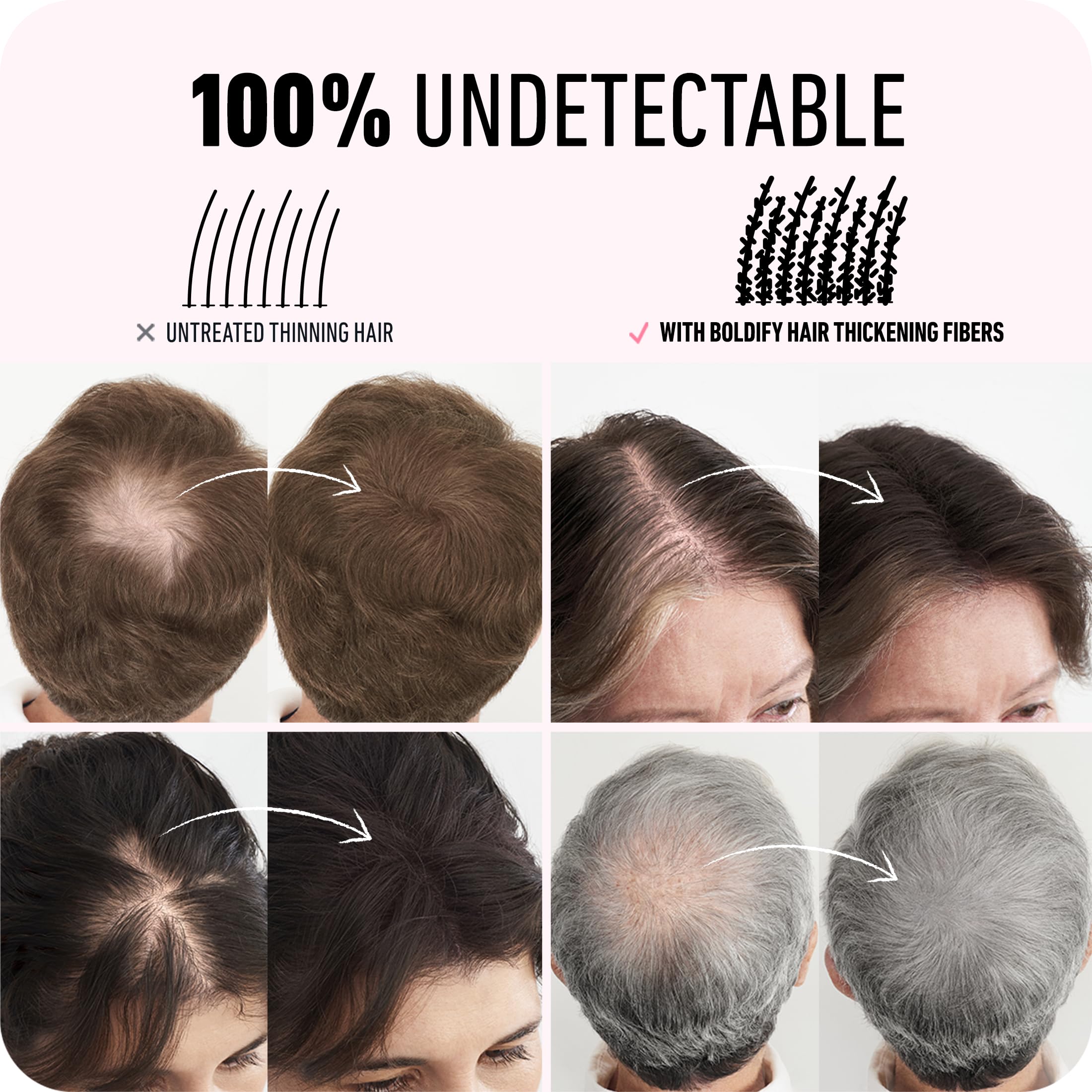 Before and after with Boldify Hazel Brown showing improved hair density