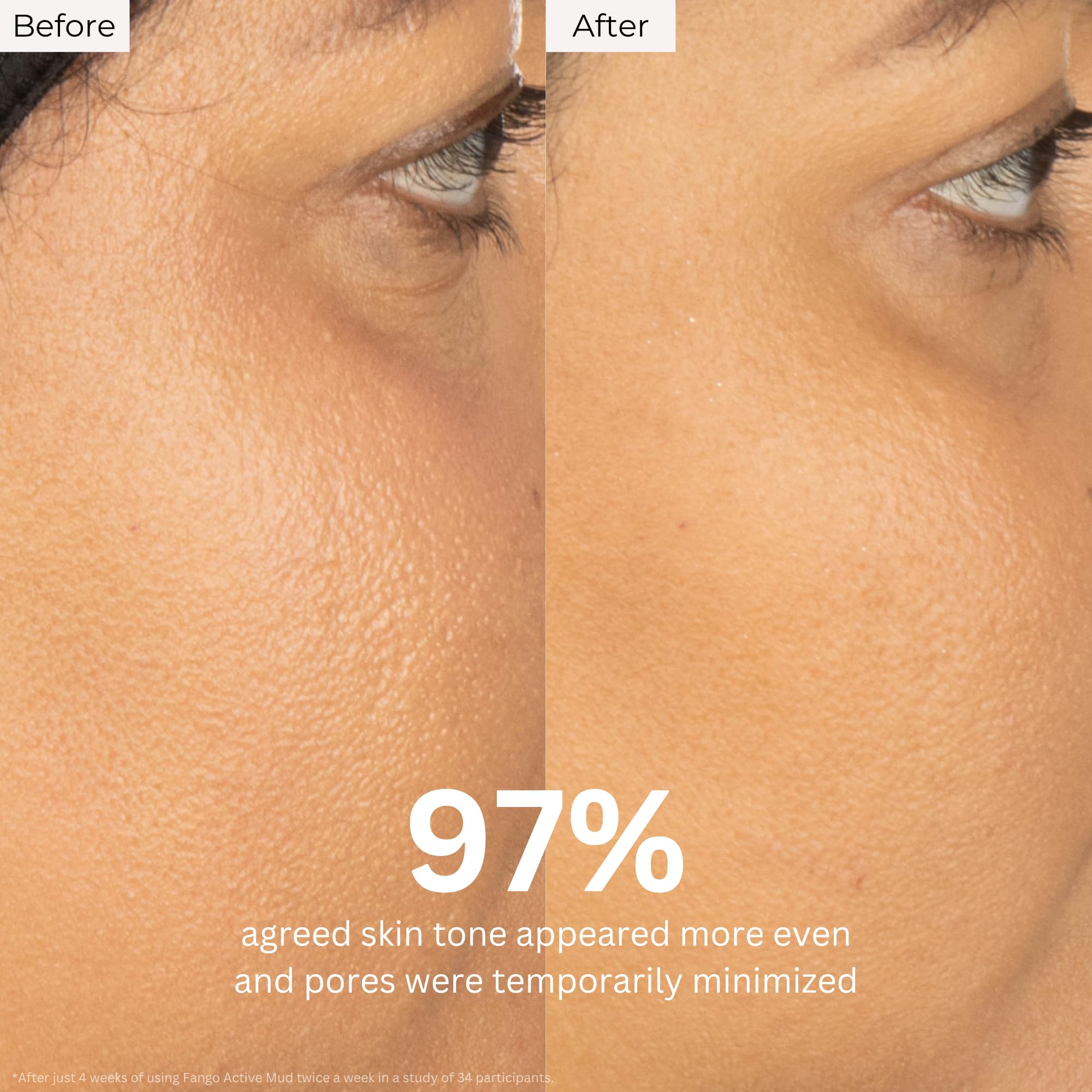 Borghese mask being applied to face demonstrating targeted pore-clearing benefit