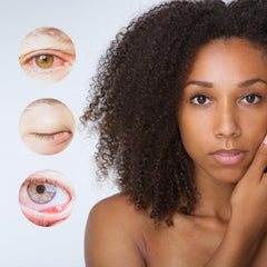 brazmedics label ingredients shown clearly to confirm hyaluronic acid, calendula, and arnica