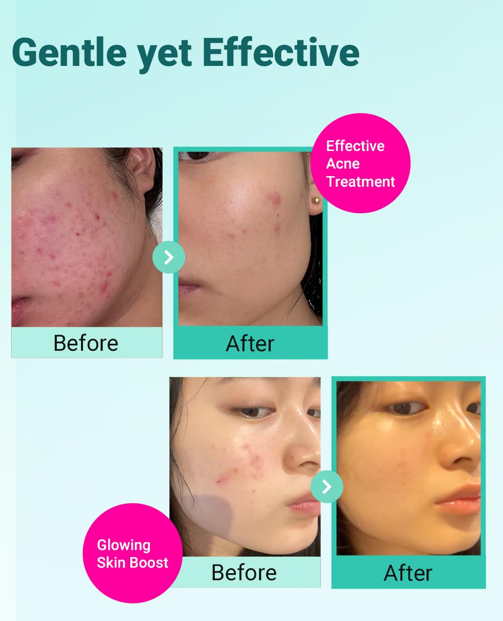 bring green tea tree cica cream open tube hydrating without greasy residue