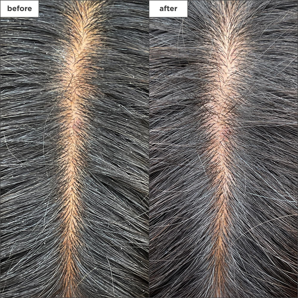 Briogeo mask being applied to scalp demonstrating soothing effect