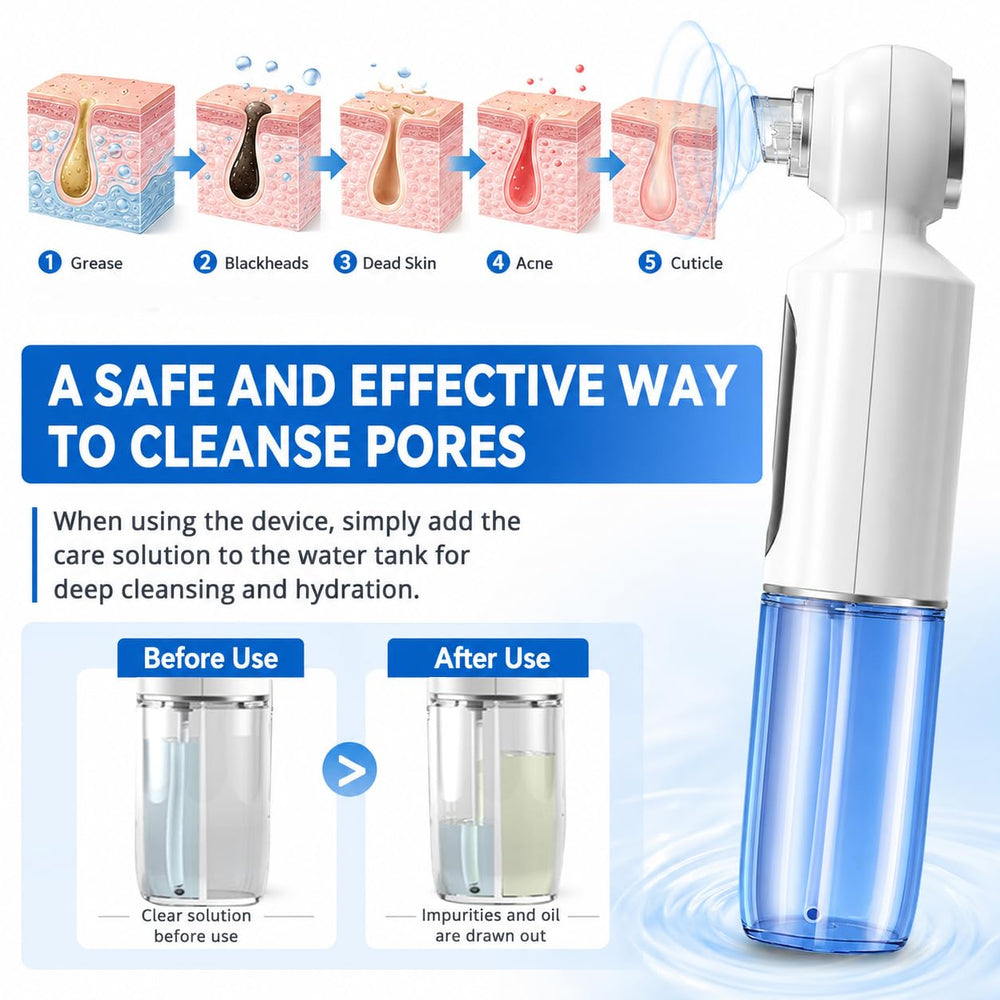 Bryzalor device hot-compress indicator illuminated to prep pores and soften debris