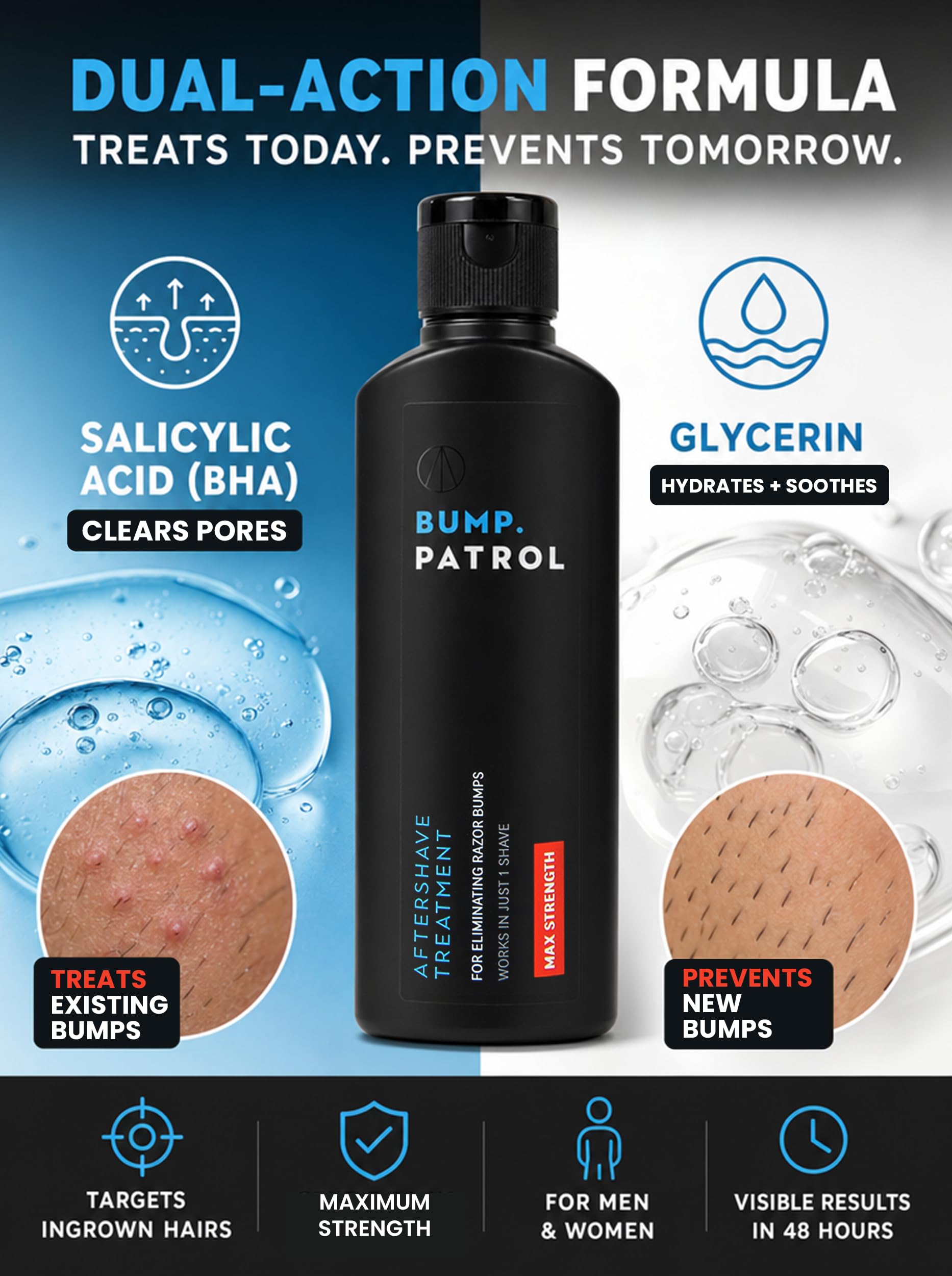 Bump Patrol used in bikini area demonstrating gentle soothing and ingrown hair help