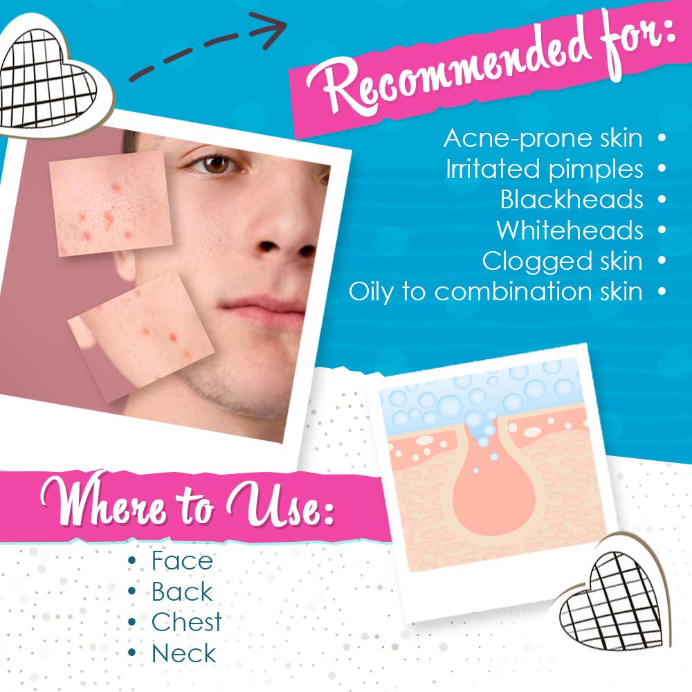 Bye Bye Blemish cotton swab applying solution to a single pimple demonstrating targeted use