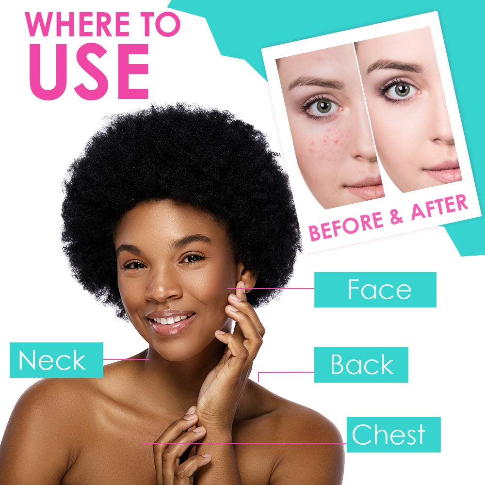 Bye Bye Blemish bottle on bathroom counter suggesting easy nightly routine