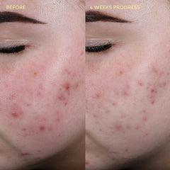 BYOMA toner fine mist spray closeup providing instant cooling comfort