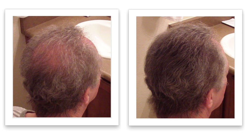 Caboki fibers in bright light illustrating undetectable finish and realistic appearance benefit