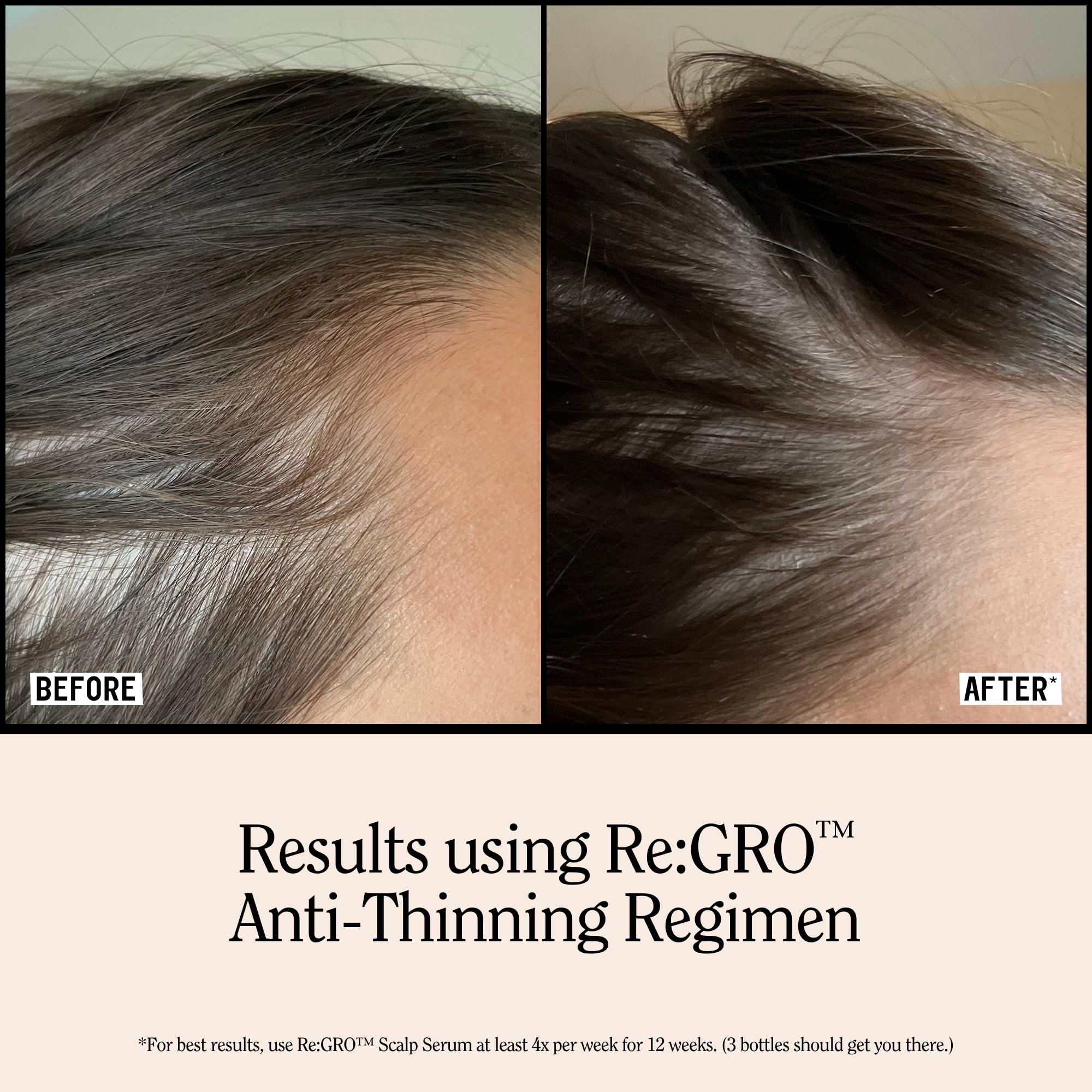 California Naturals in-shower use demonstrating scalp massage benefit