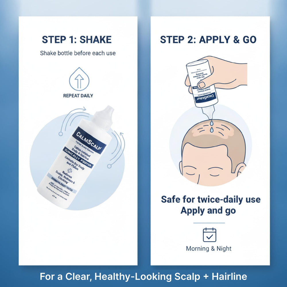CalmScalp application with dropper on scalp offering targeted relief