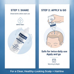 CalmScalp application with dropper on scalp offering targeted relief