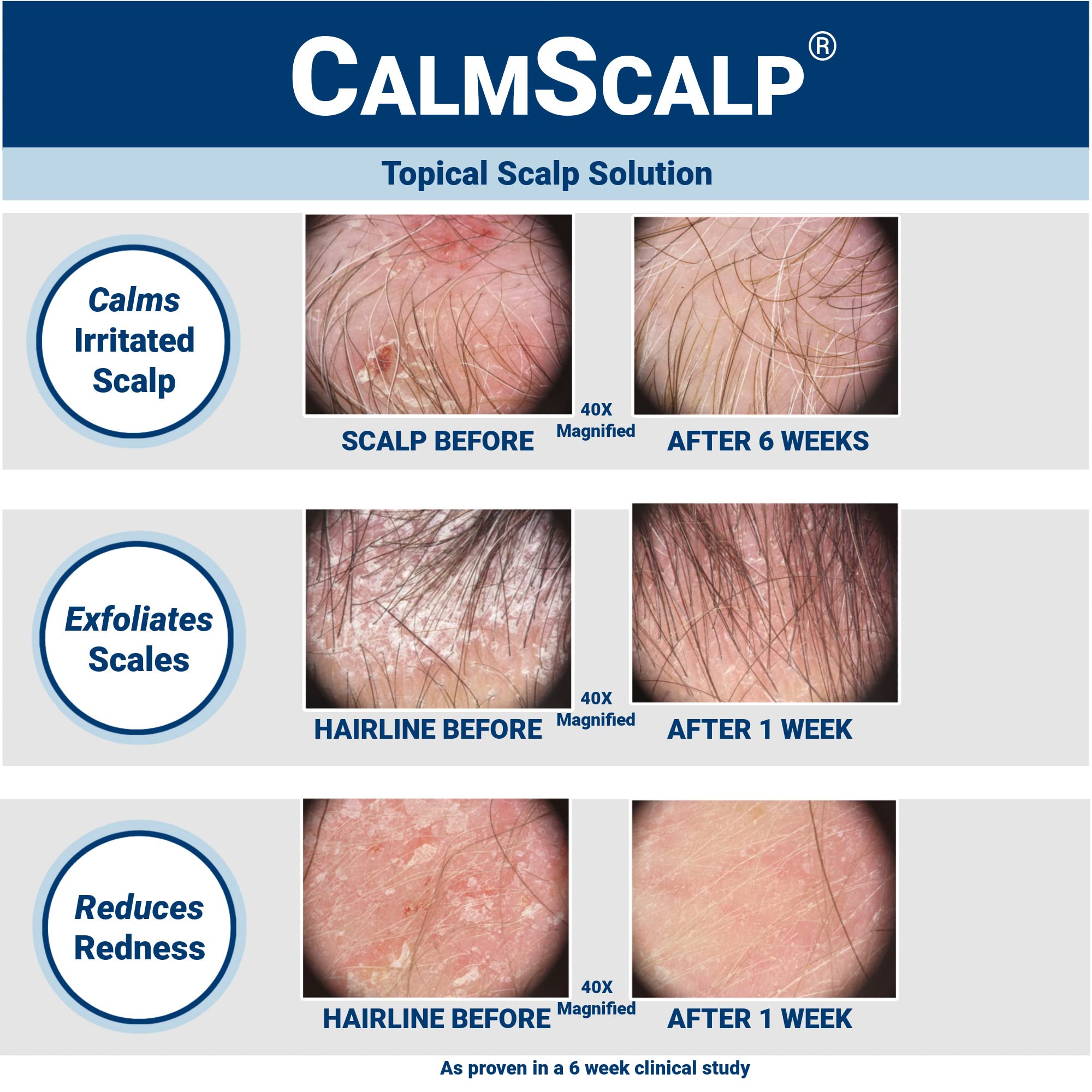 CalmScalp texture close-up demonstrating lightweight serum absorption