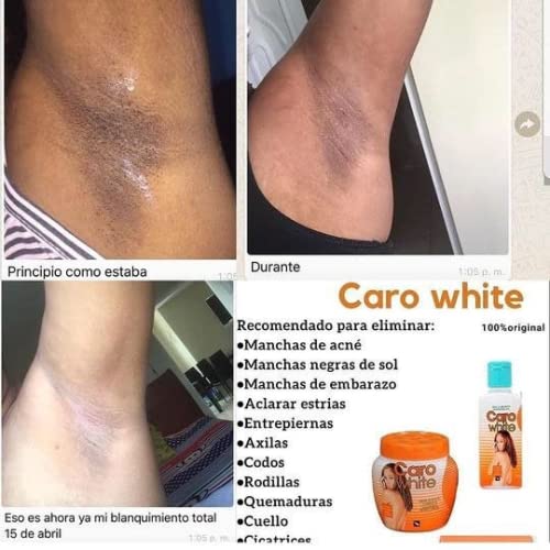Caro White lotion and cream texture close-up demonstrating quick absorption and hydrating finish