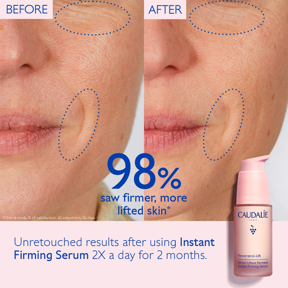 Caudalie Firming Eye Gel Cream being applied to under-eye, reducing puffiness