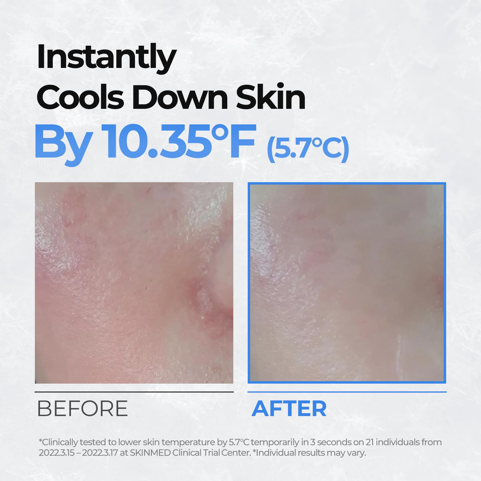 Cell Fusion C before and after pore view, displays visible pore-refining benefit