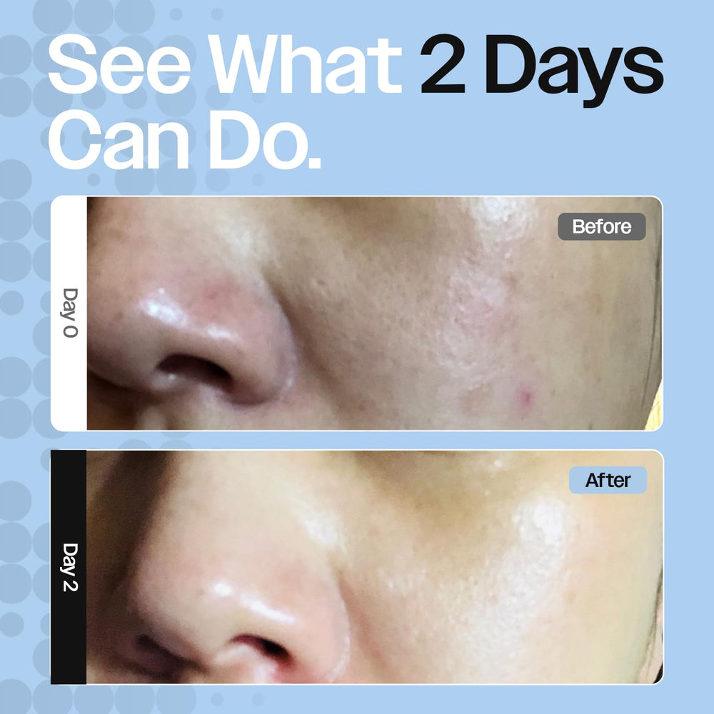 CELRIV ingredient collage highlighting postbiotic and hyaluronic acid benefits