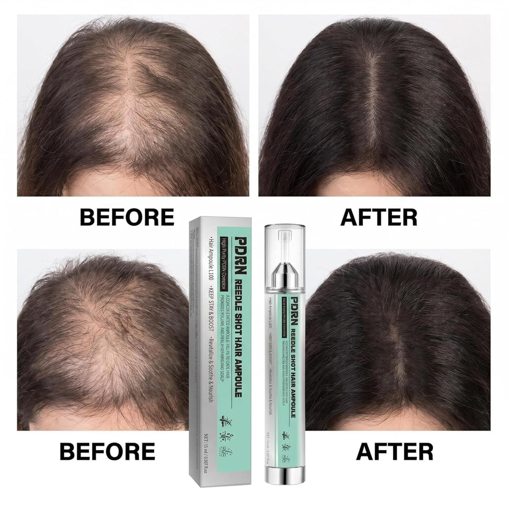 Ceskidro Reedle Shot on bathroom shelf styled for at-home salon-style scalp care