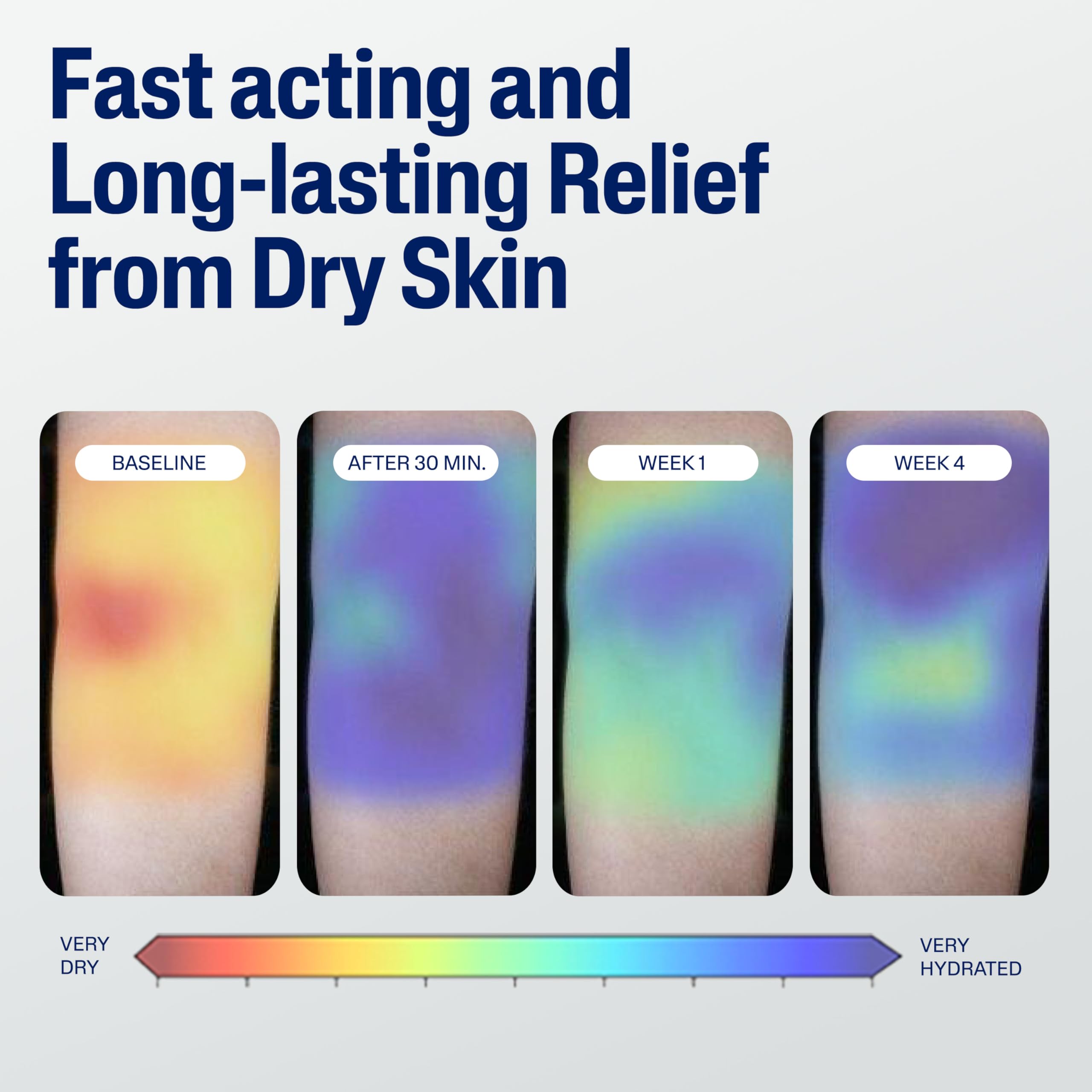 Using Cetaphil on elbow and knee to restore dry rough areas