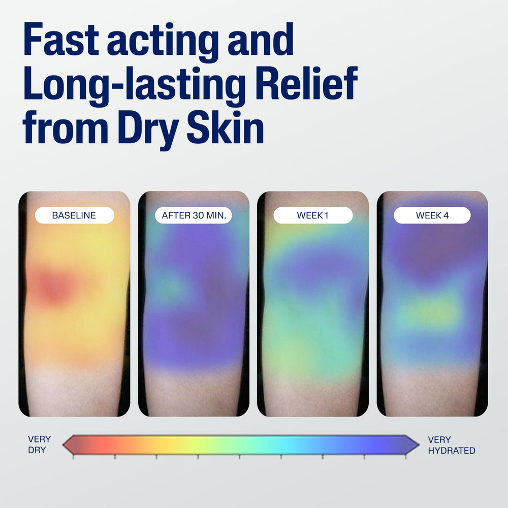 Using Cetaphil on elbow and knee to restore dry rough areas