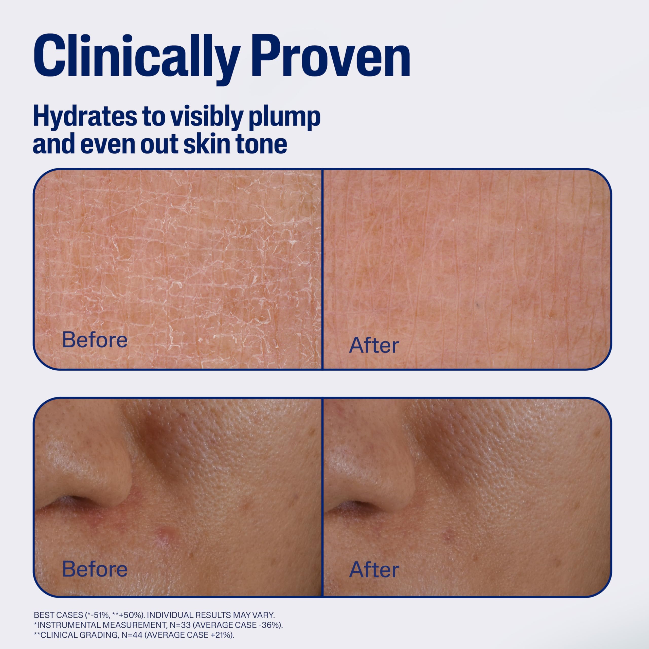 Cetaphil Gallic-AOX display emphasizing antioxidant defense for skin