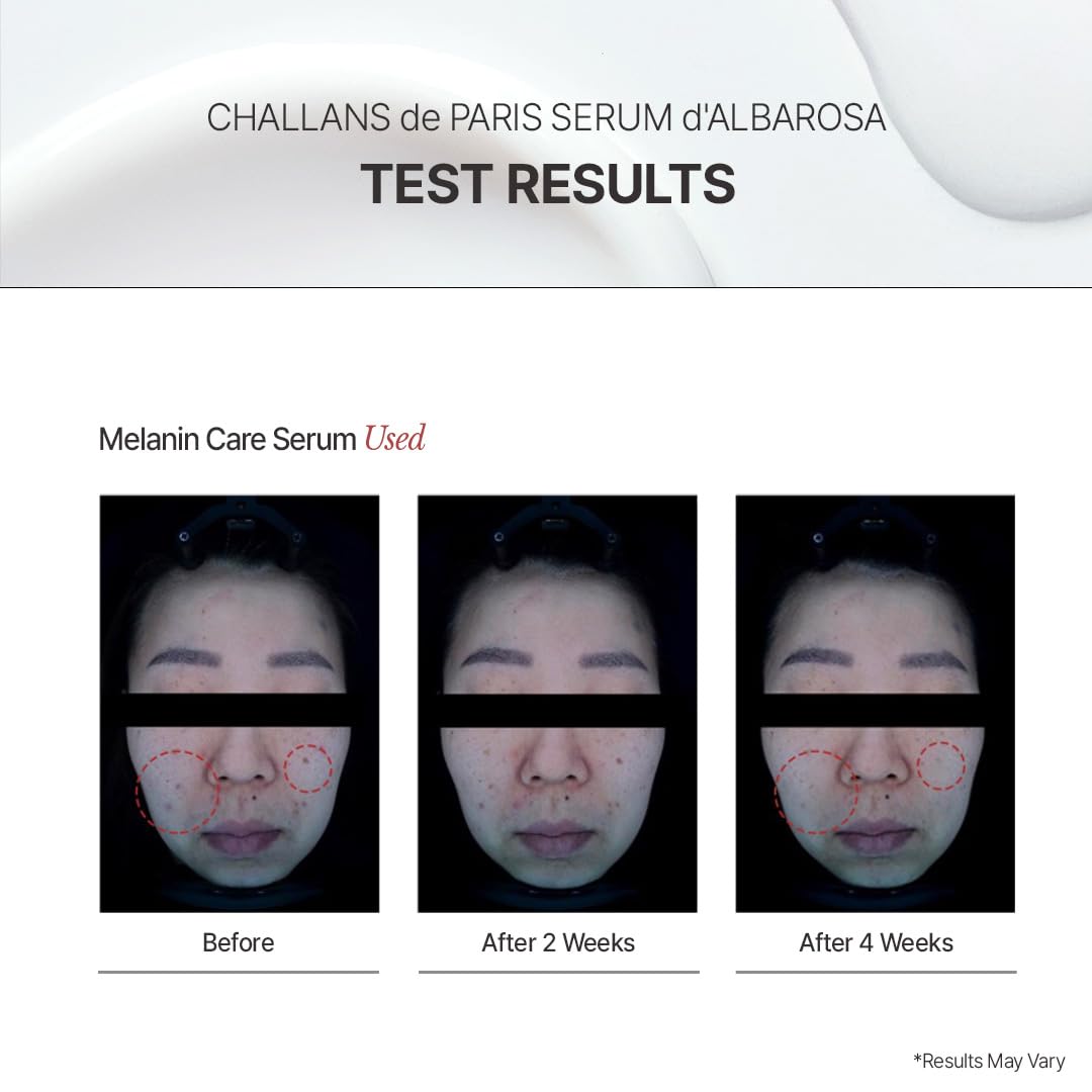 CHALLANS DE applying ampoule to face showing even-tone benefit
