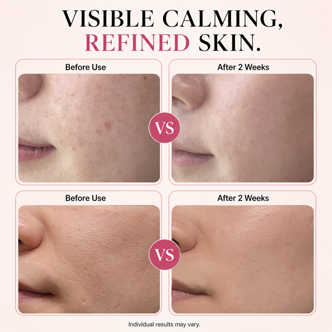 CHALTTOK serum dispensing dropper demonstrating easy controlled application benefit