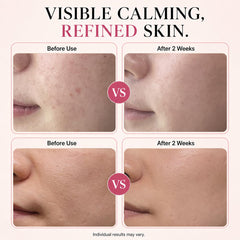 CHALTTOK serum dispensing dropper demonstrating easy controlled application benefit