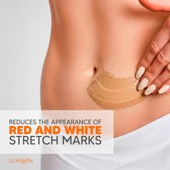 Cicatrissim cream applied to skin illustrating softened appearance