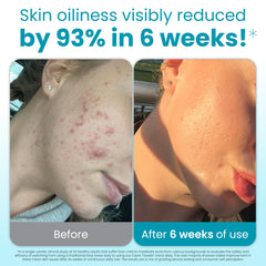 CLEAN SKIN CLUB close-up of raised-dot texture providing controlled exfoliation