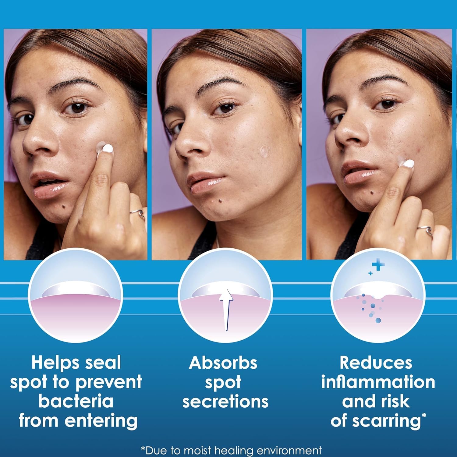 Clearasil patch adhered to cheek for daytime wear offering discreet protection and confidence