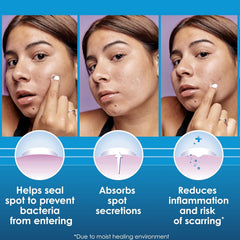Clearasil patch adhered to cheek for daytime wear offering discreet protection and confidence