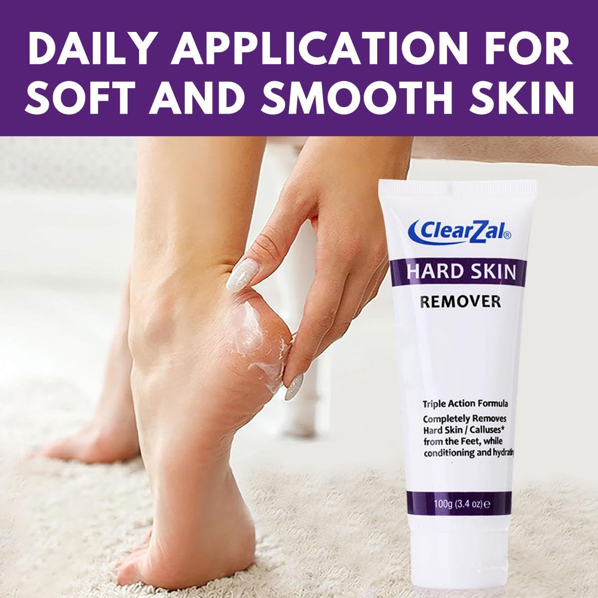 Clearzal being applied to heel demonstrating softening and comfort