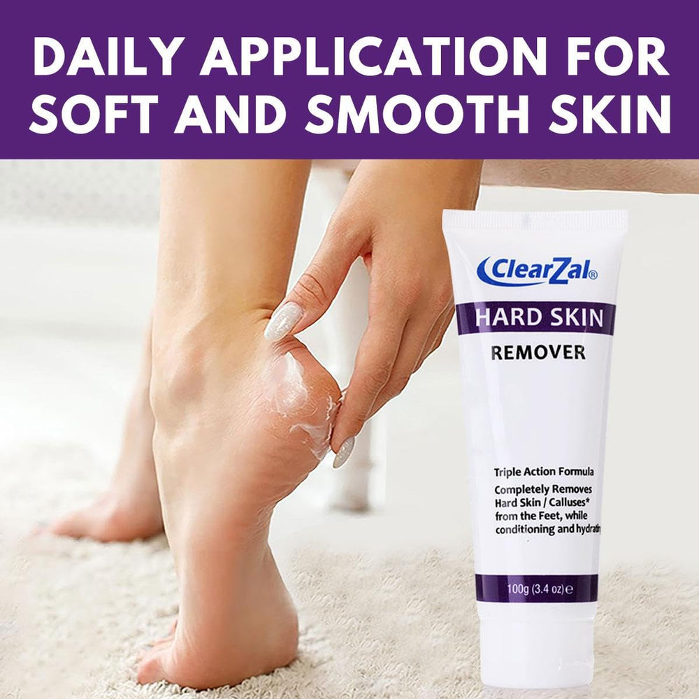 Clearzal being applied to heel demonstrating softening and comfort