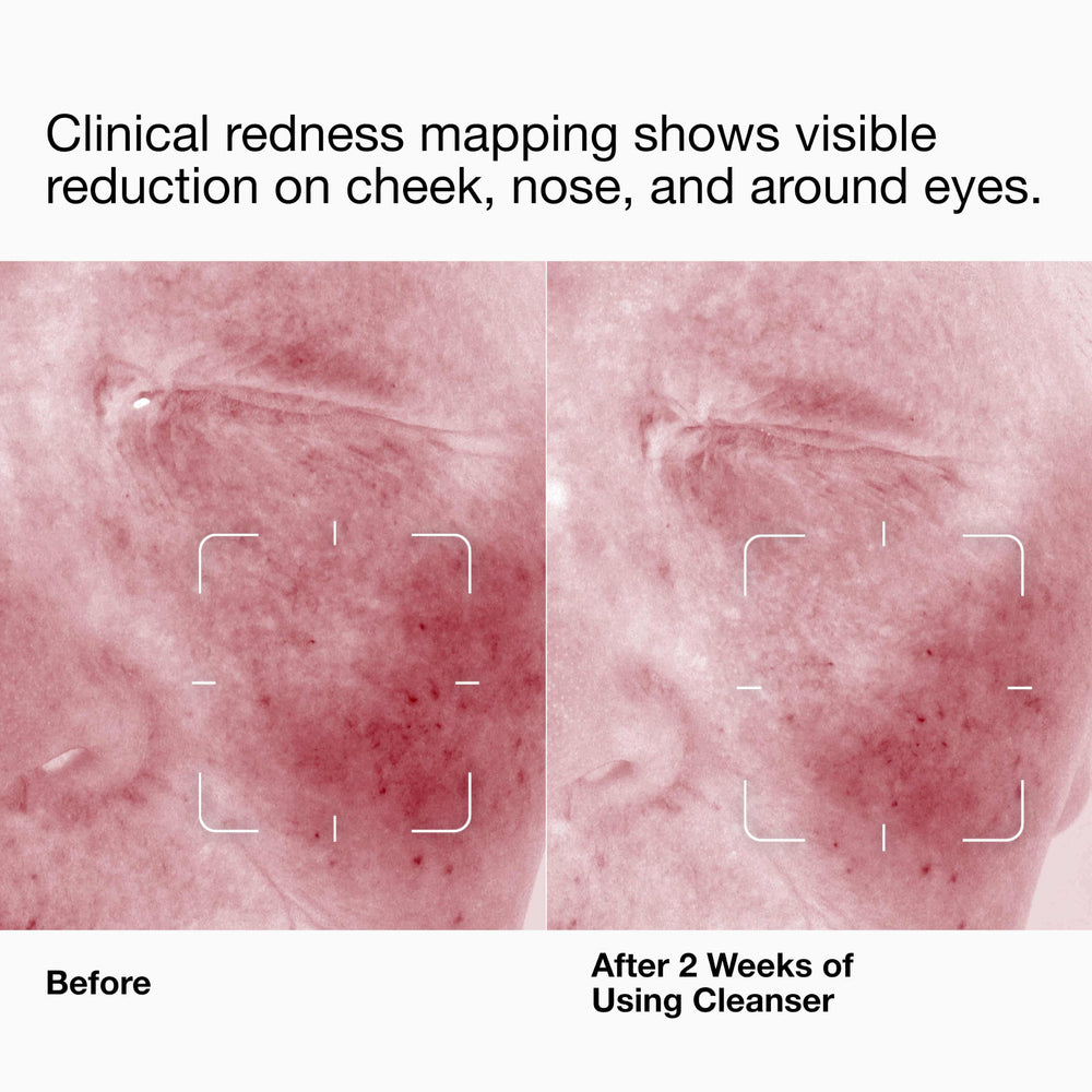 Clinique close-up cream texture illustrating smooth, hydrating finish