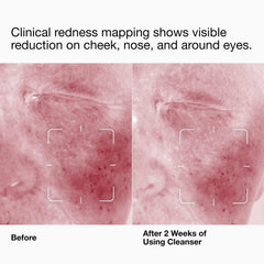 Clinique close-up cream texture illustrating smooth, hydrating finish