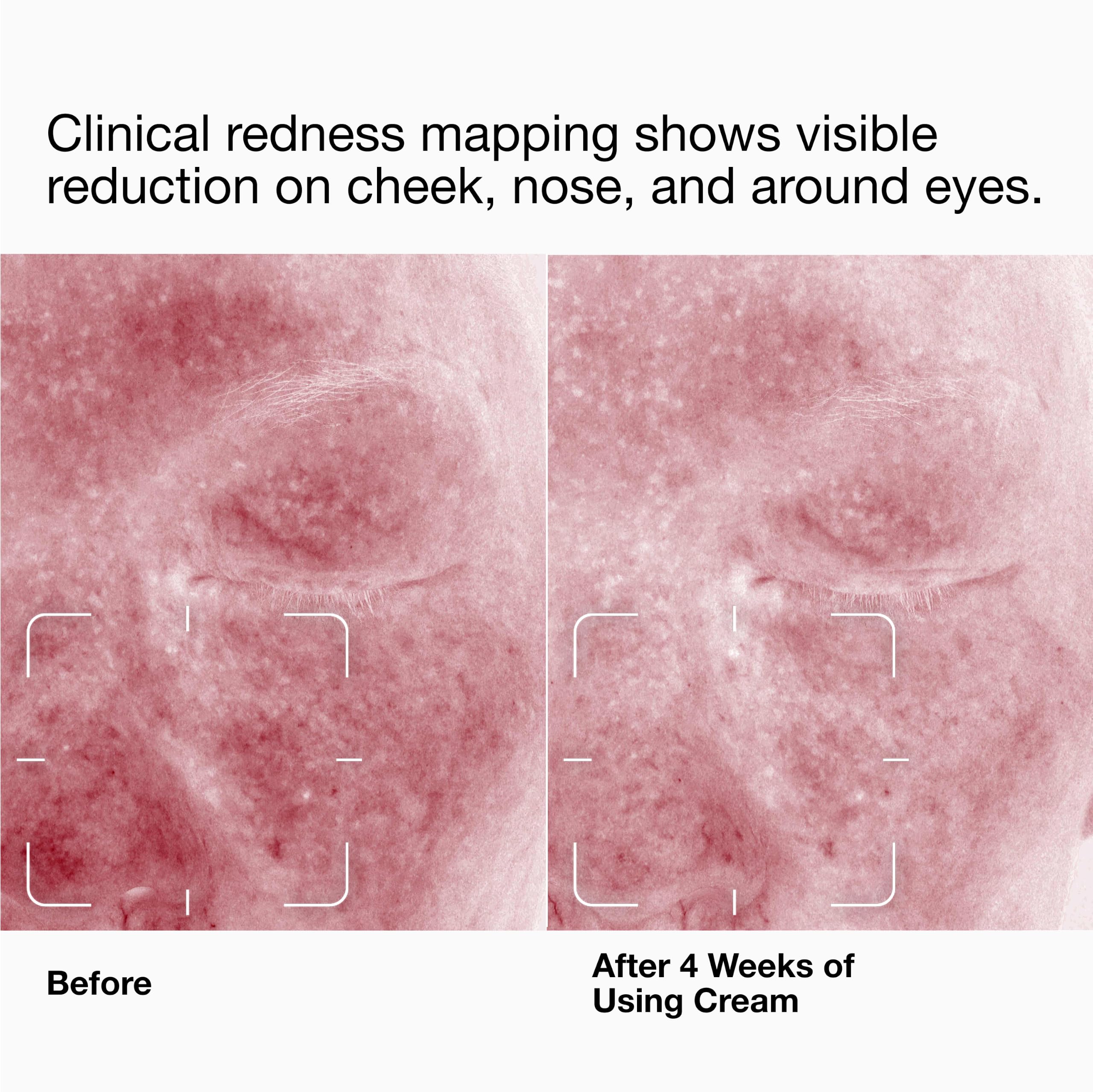 Clinique cream spread on skin close-up demonstrating fast absorption