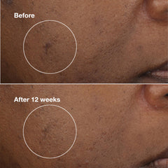 Label detail of Clinique active ingredients for targeted brightening