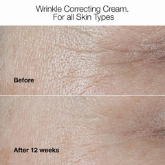 Clinique hyaluronic acid and peptide ingredients displayed to highlight firming benefits