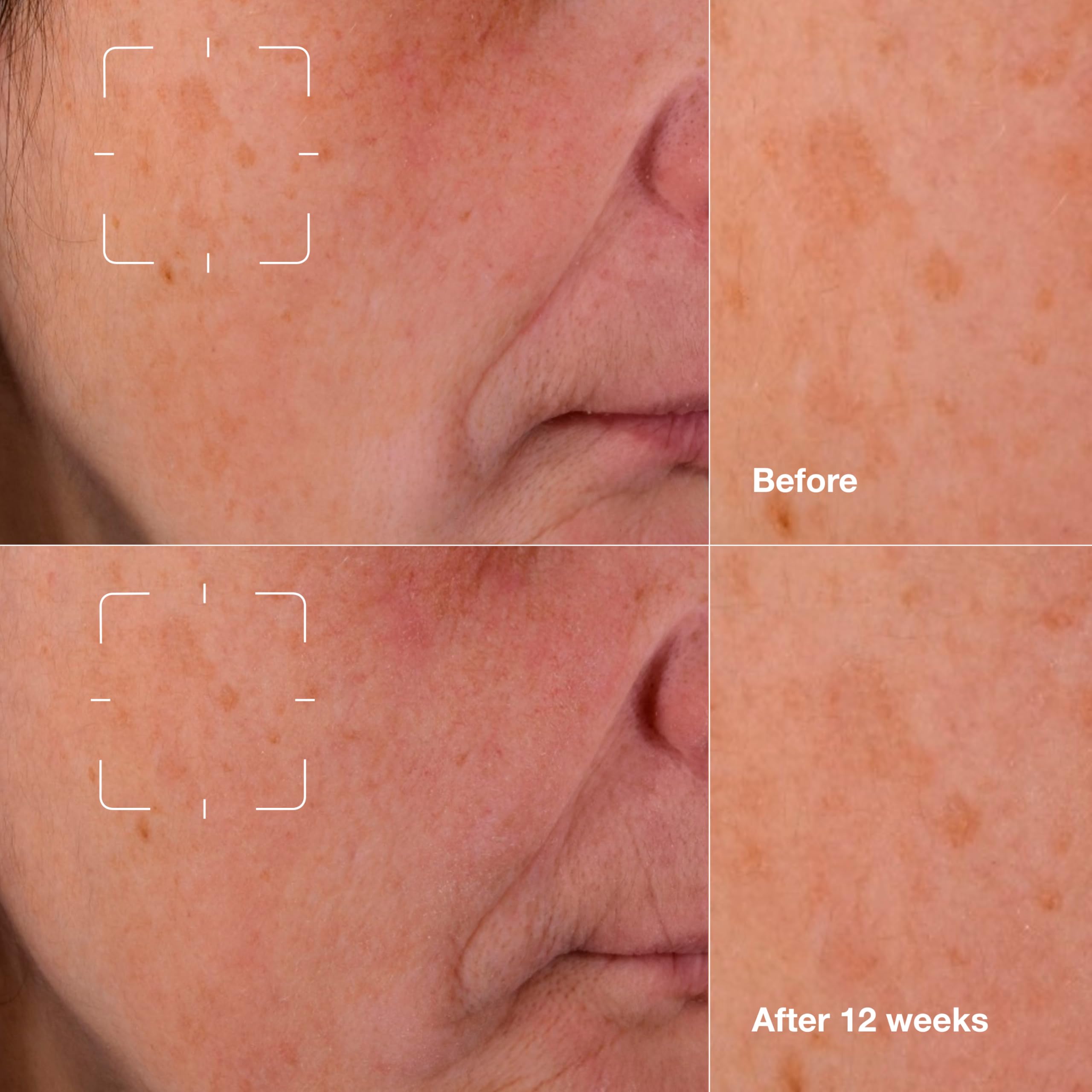 Clinique pump dispensing serum on hand highlighting fast-absorbing, non-greasy benefit