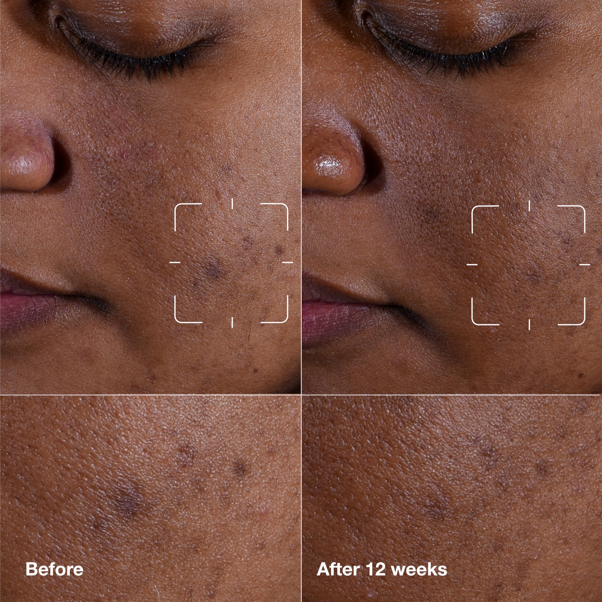 Clinique close-up of serum dropper texture demonstrating lightweight absorption benefit