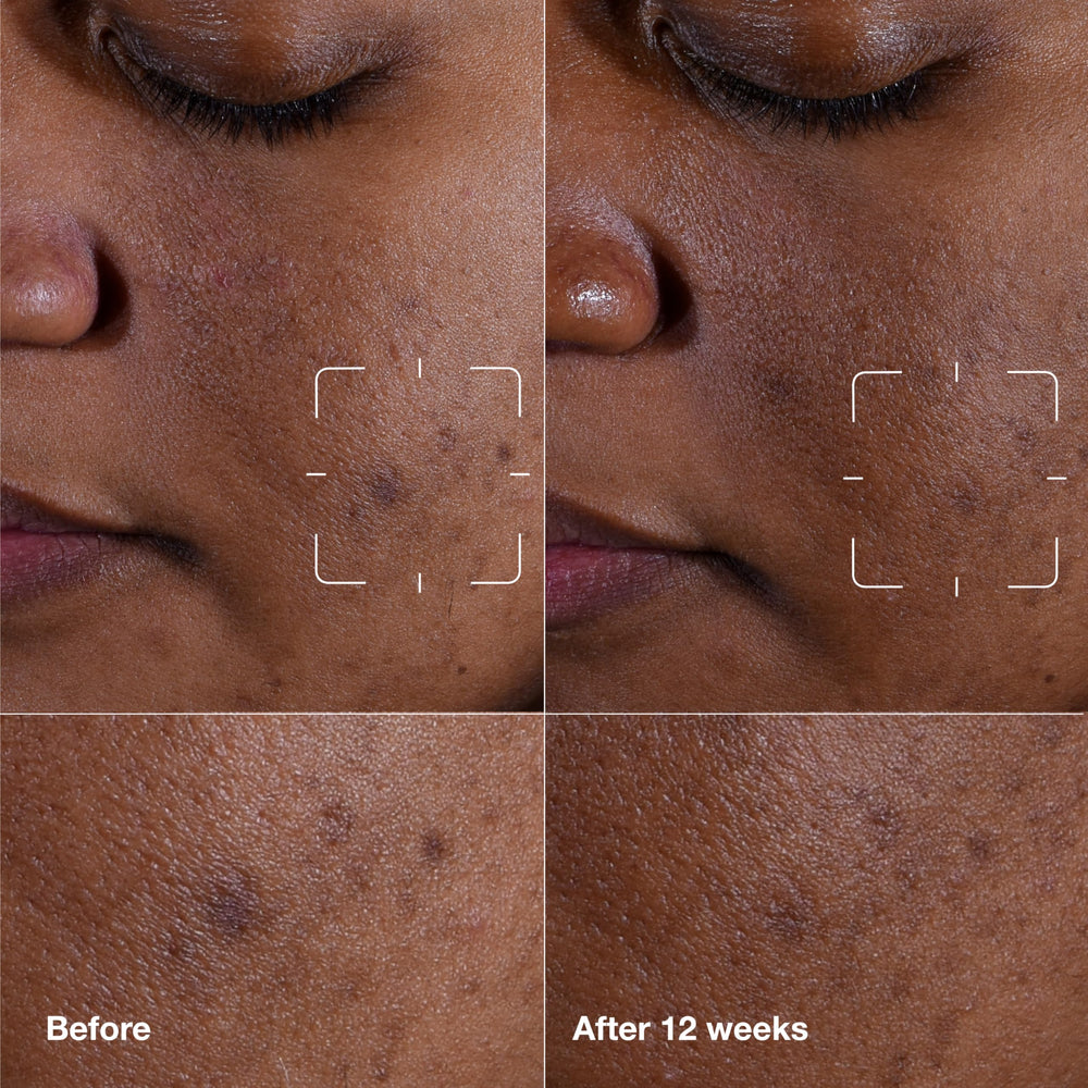 Clinique close-up of serum dropper texture demonstrating lightweight absorption benefit