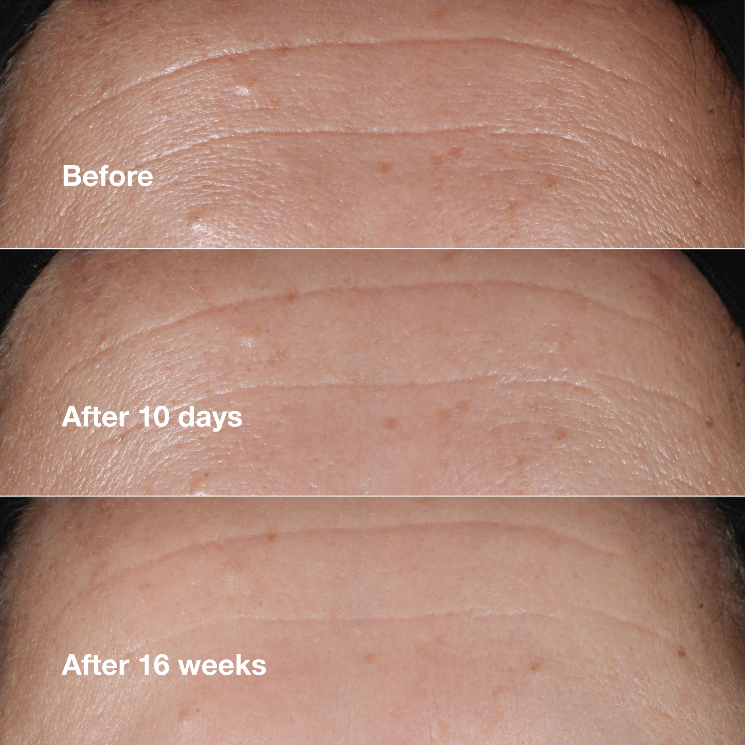 Clinique bottle in hand for size perspective and travel-friendly benefit