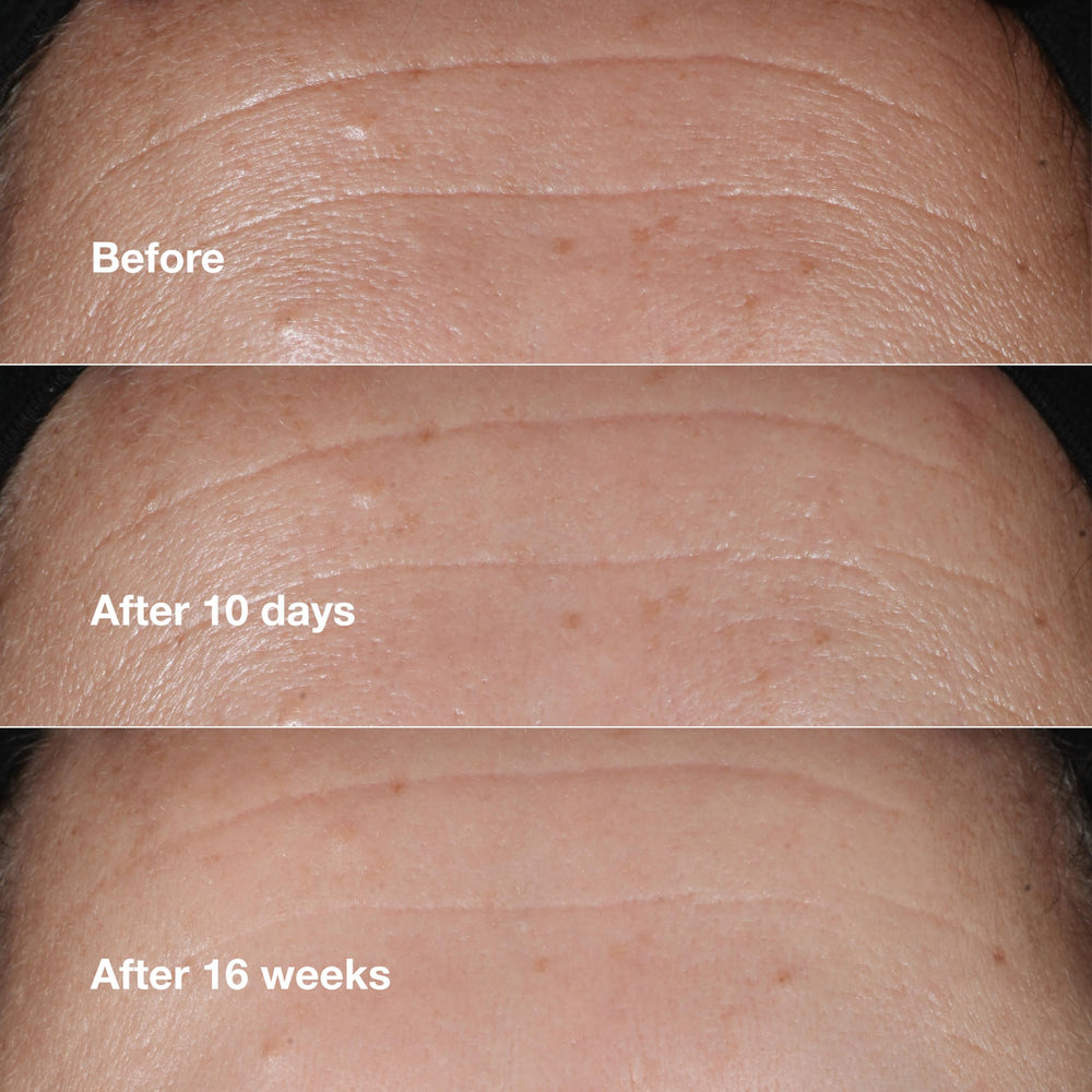 Clinique bottle in hand for size perspective and travel-friendly benefit