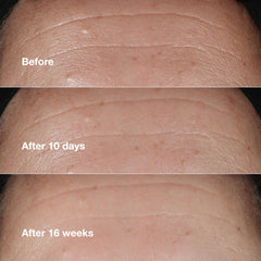 Clinique bottle in hand for size perspective and travel-friendly benefit