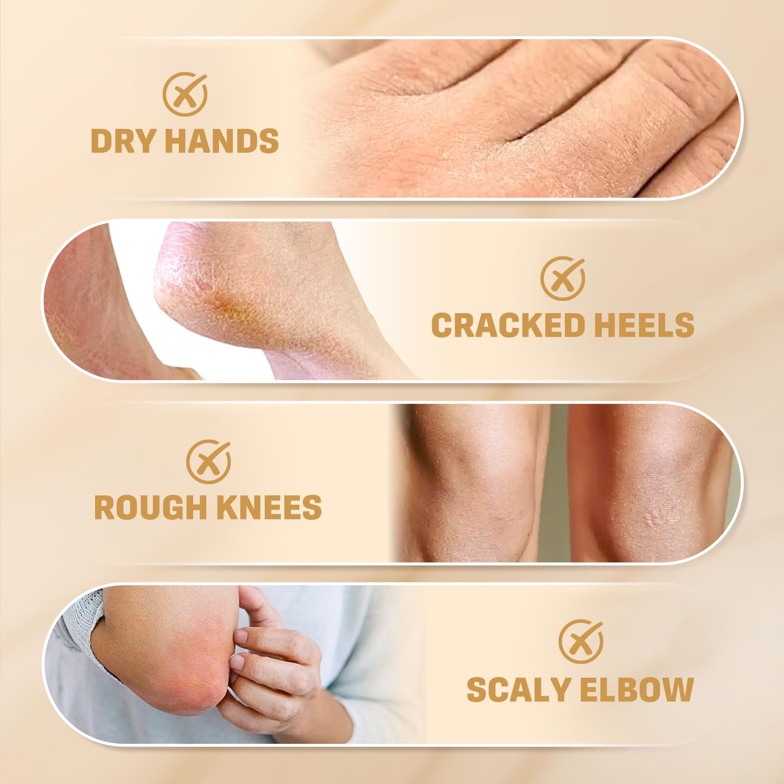 Clyecfra before-and-after feet comparison showing improved softness benefit