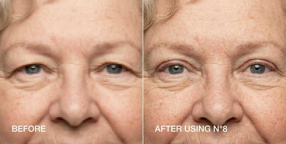 Contours Rx application with tweezers demonstrating precise placement