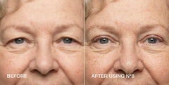 Contours Rx application with tweezers demonstrating precise placement