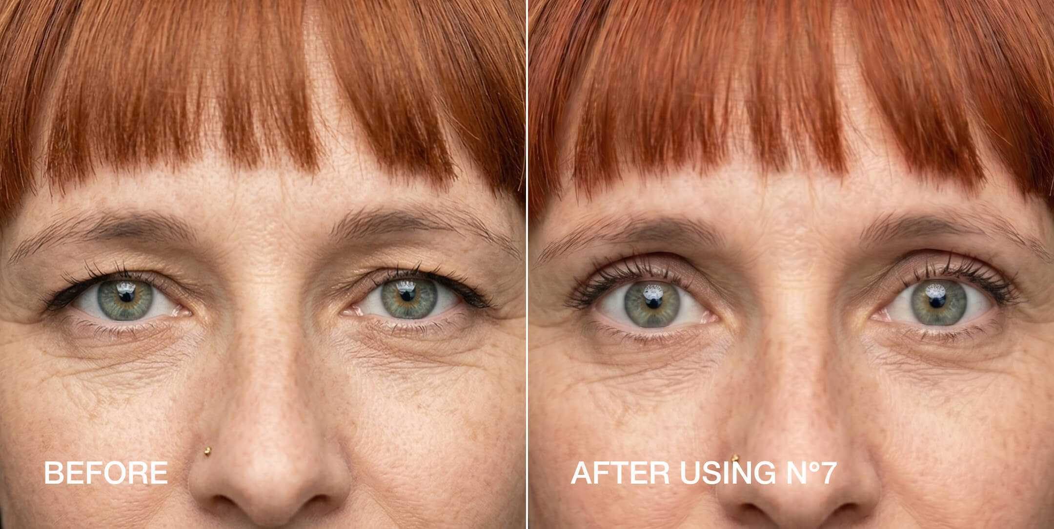 Contours Rx before and after hooded eyelid lift showing symmetry benefit