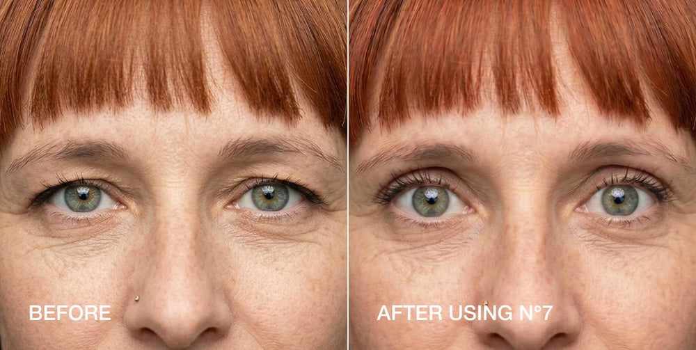 Contours Rx before and after hooded eyelid lift showing symmetry benefit
